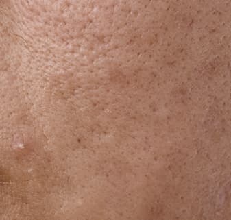 Clarity skin domain texture