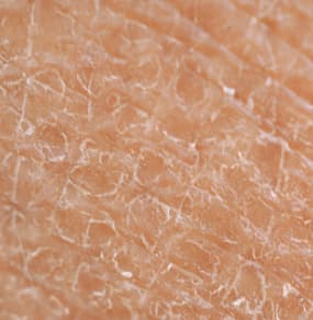 Hydration skin domain texture