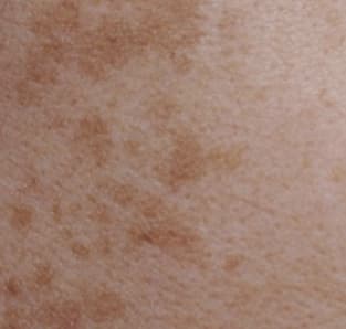 Pigmentation skin domain texture