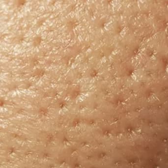 Texture skin domain texture